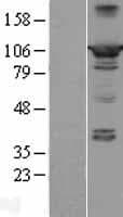 PPFIBP2 Protein (Over-Expression Lysate Myc-DDK (Flag))