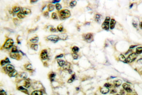 Polyclonal Rabbit anti-Human PCNA Antibody (Ile88, IHC, WB)