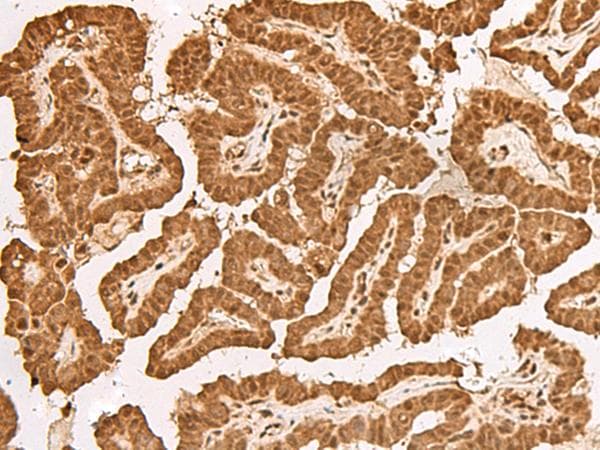 Polyclonal Rabbit anti-Human TIPRL / TIP Antibody (IHC)