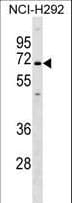 KCNN1 Antibody (aa391-419)
