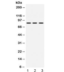 CCM1 / KRIT1 Antibody
