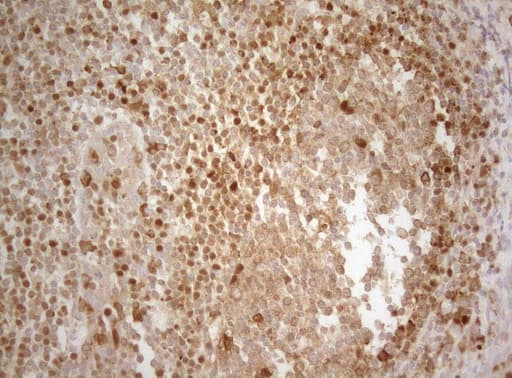 ALOX5 / 5-LOX Antibody (aa18-364, clone OTI2C5)
