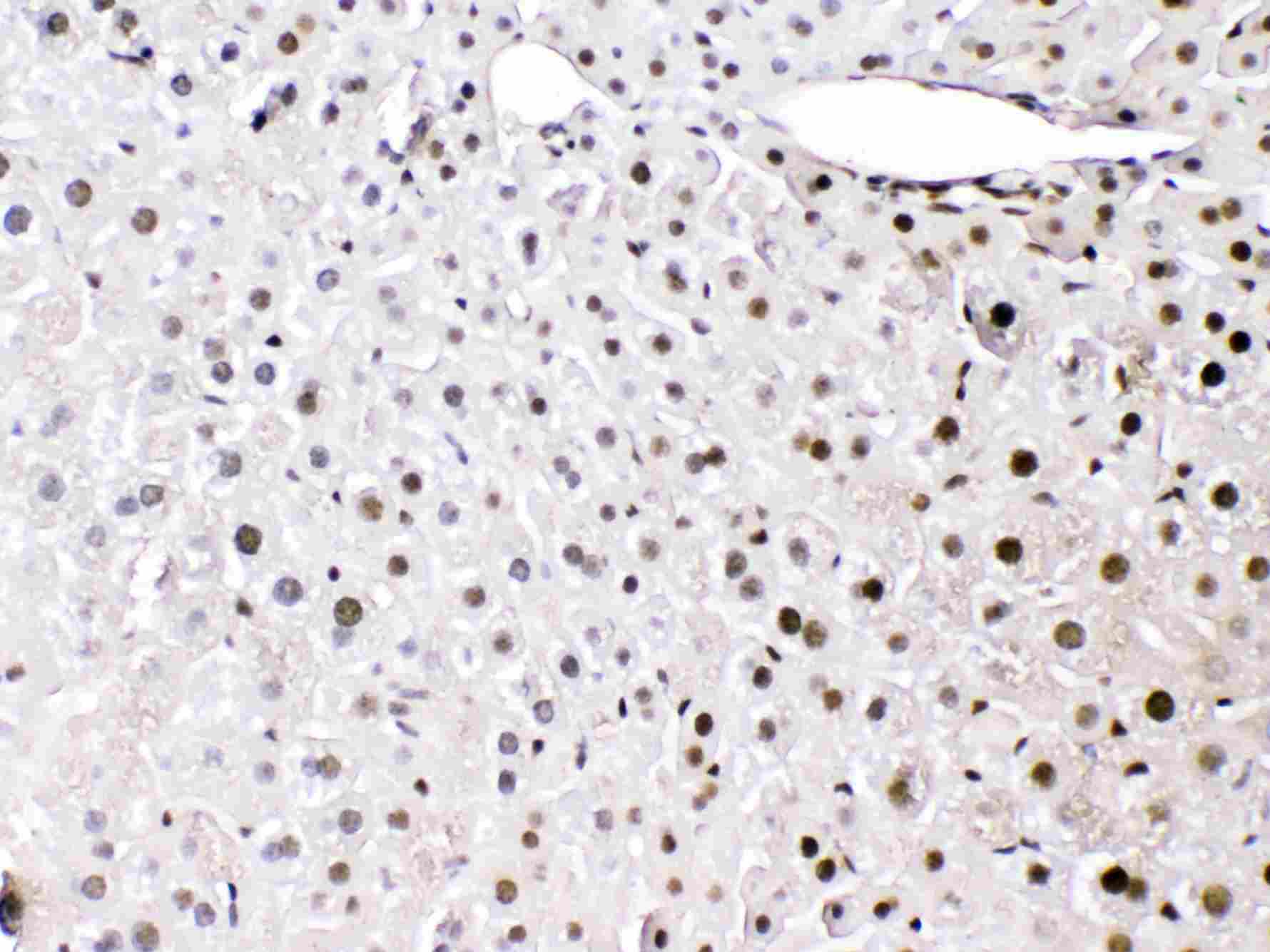 HMG1 / HMGB1 Antibody