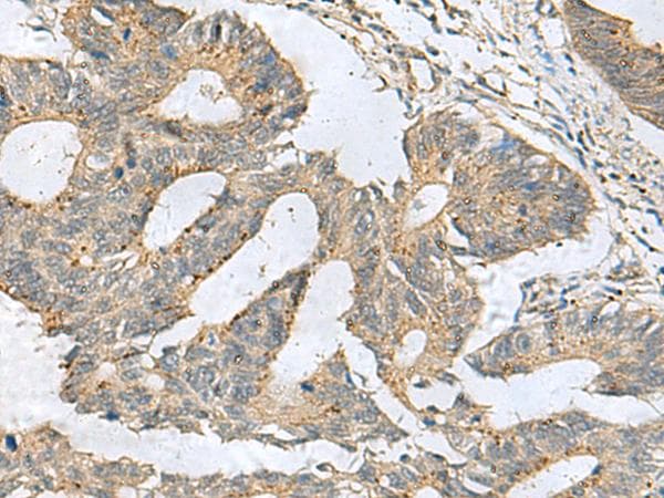 CXCR5 Antibody