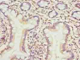 Polyclonal Rabbit anti-Human TMEM154 Antibody (IHC, WB)
