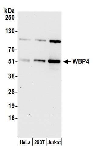 WBP4 Antibody (aa125-175)