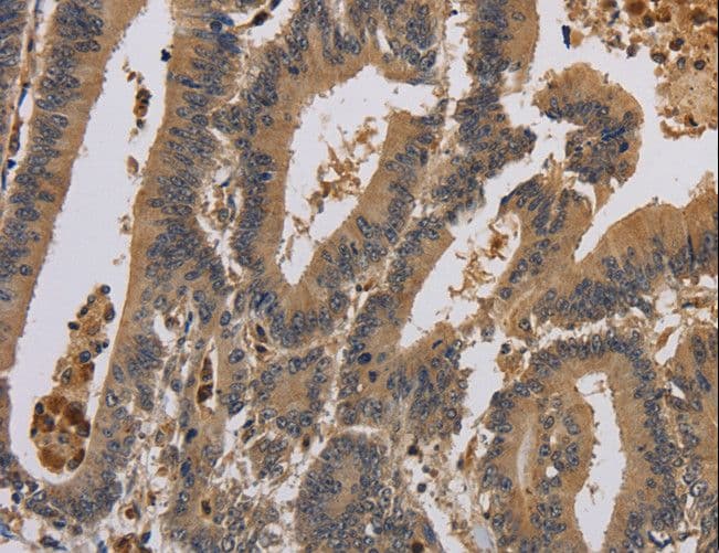 Polyclonal Rabbit anti-Human KCNA7 / Kv1.7 Antibody (IHC, WB)
