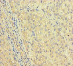 IGHG1 / IgG Antibody