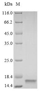 Rat VAMP2 / VAMP-2 Protein (Recombinant 6His, N-terminus)