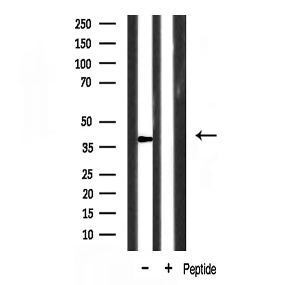 EAR2 / NR2F6 Antibody