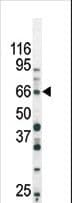 SMAD3 Antibody (phospho-Ser213)