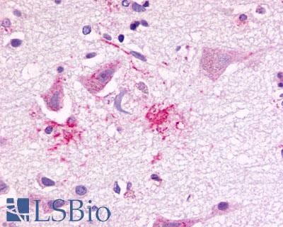 PathPlus™ Polyclonal Rabbit anti-Human FKSG80 / GPR81 Antibody (Extracellular Domain, IHC)