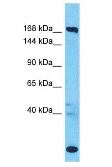 SUPT6H / SPT6 Antibody (aa1660-1709)