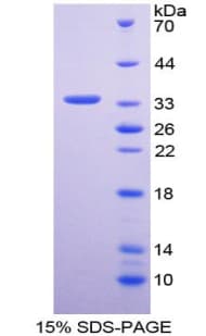 Human HMG2L1 / HMGXB4 Protein (Recombinant His-T7)