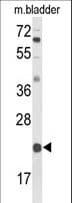 DGCR6 Antibody (aa103-129)