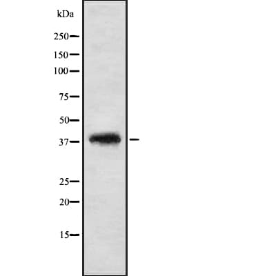 VSX2 / CHX10 Antibody