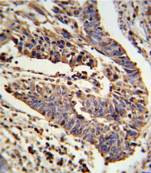 Polyclonal Rabbit anti-Human SCNN1A / ENaC Alpha Antibody (aa365-391, IHC, IF, WB)