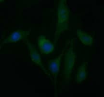 PDGFRB / PDGFR Beta Antibody (clone OTI1G9)