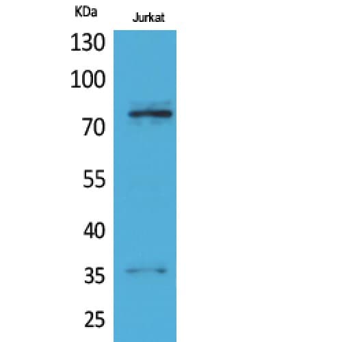 Polyclonal Rabbit anti-Human TP73 / p73 Antibody (IHC, WB)