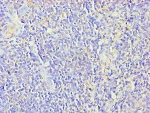 ZNF346 Antibody (aa1-294)