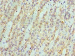 ASAH1 / Acid Ceramidase Antibody (aa146-395)
