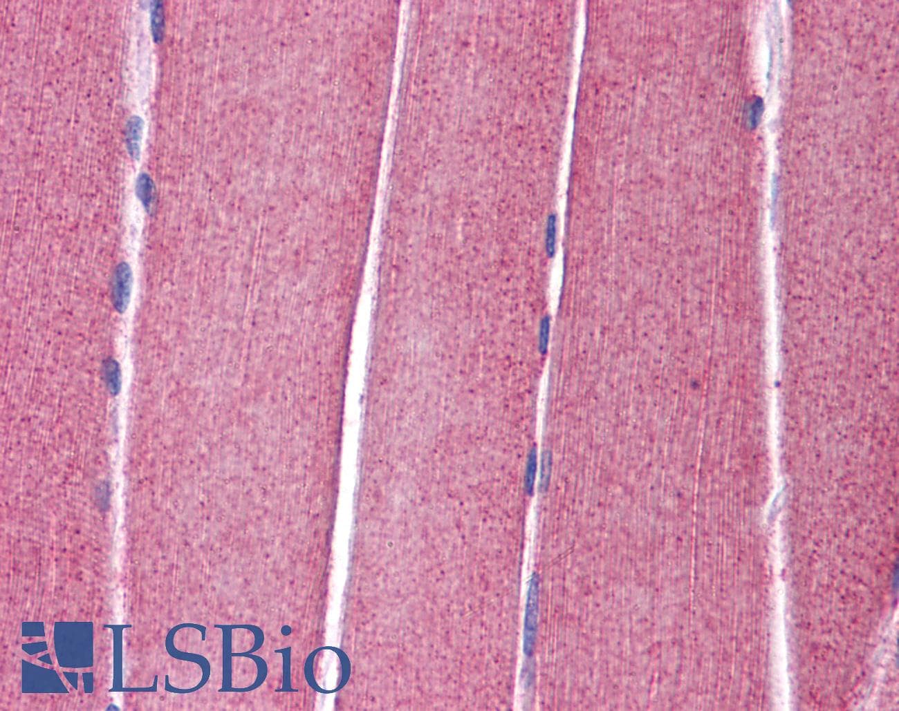 KCNC4 / Kv3.4 Antibody (aa252-301)