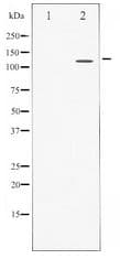 Polyclonal Rabbit anti-Human STAT2 Antibody (IHC, WB)