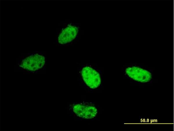 IHC-plus™ Monoclonal Mouse anti-Human KDM1A / LSD1 Antibody (clone 2E7, IHC, IF, WB)