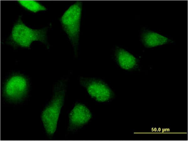 PFDN2 Antibody (clone 2C1)