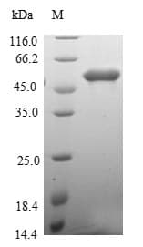 Human MEMO1 Protein (Recombinant GST, N-terminus)