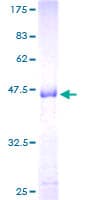 Human PRL / Prolactin Protein (Recombinant GST)