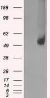 SLC2A5 / GLUT5 Antibody (clone OTI14C8)