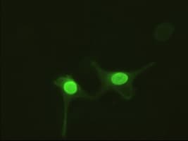 Monoclonal Mouse anti-Human AK1 / Adenylate Kinase 1 Antibody (clone OTI18C7, IF, WB)