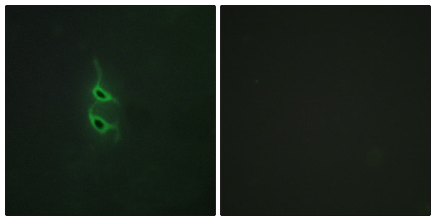 MRC2 / Endo180 Antibody (aa121-170)
