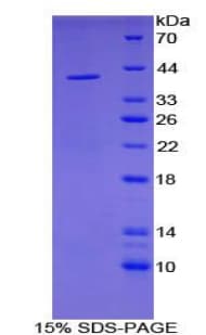 Mouse IL1R1 Protein (Recombinant His-T7)