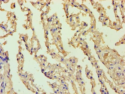 BCL10 / BCL-10 Antibody