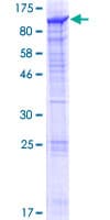 Human KIAA1841 Protein (Recombinant GST)
