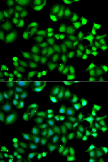 MAPKAPK3 Antibody (AP)