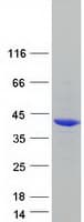 Human PHYHIP Protein (Recombinant Myc-DDK (Flag))