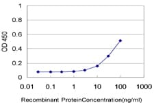 IHC-plus™ Monoclonal Mouse anti-Human NTNG2 / Netrin G2 Antibody (clone 4F11, IHC, WB)
