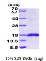 Human SEP15 Protein (Recombinant His)