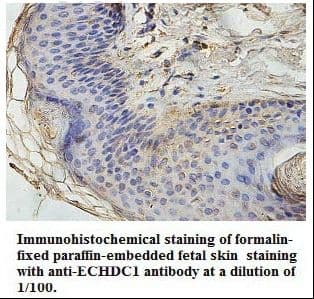 ECHDC1 Antibody (aa74-269)