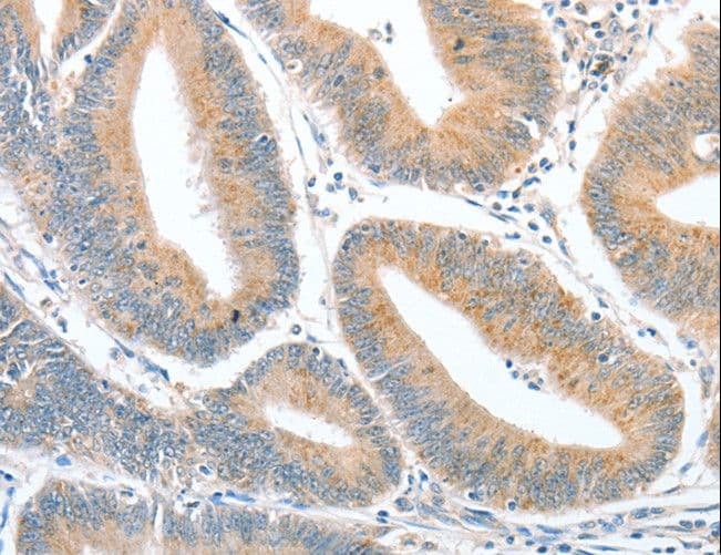 CKAP2 Antibody