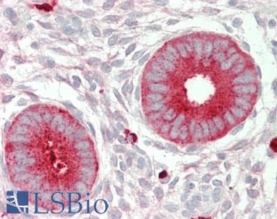 IHC-plus™ MAC-2-BP / LGALS3BP Antibody (clone 5E3)