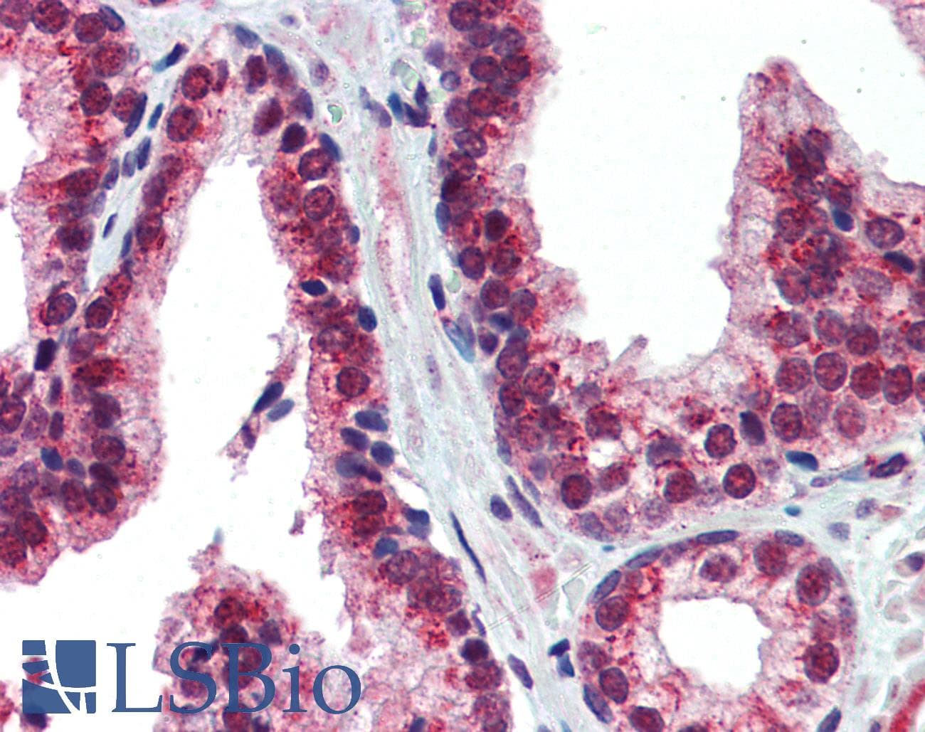 Polyclonal Rabbit anti-Human NR2E1 / TLX Antibody (aa95-144, IHC, WB)