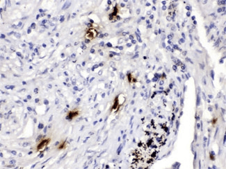 Polyclonal Rabbit anti-Human TPSAB1 / Mast Cell Tryptase Antibody (IHC, WB)