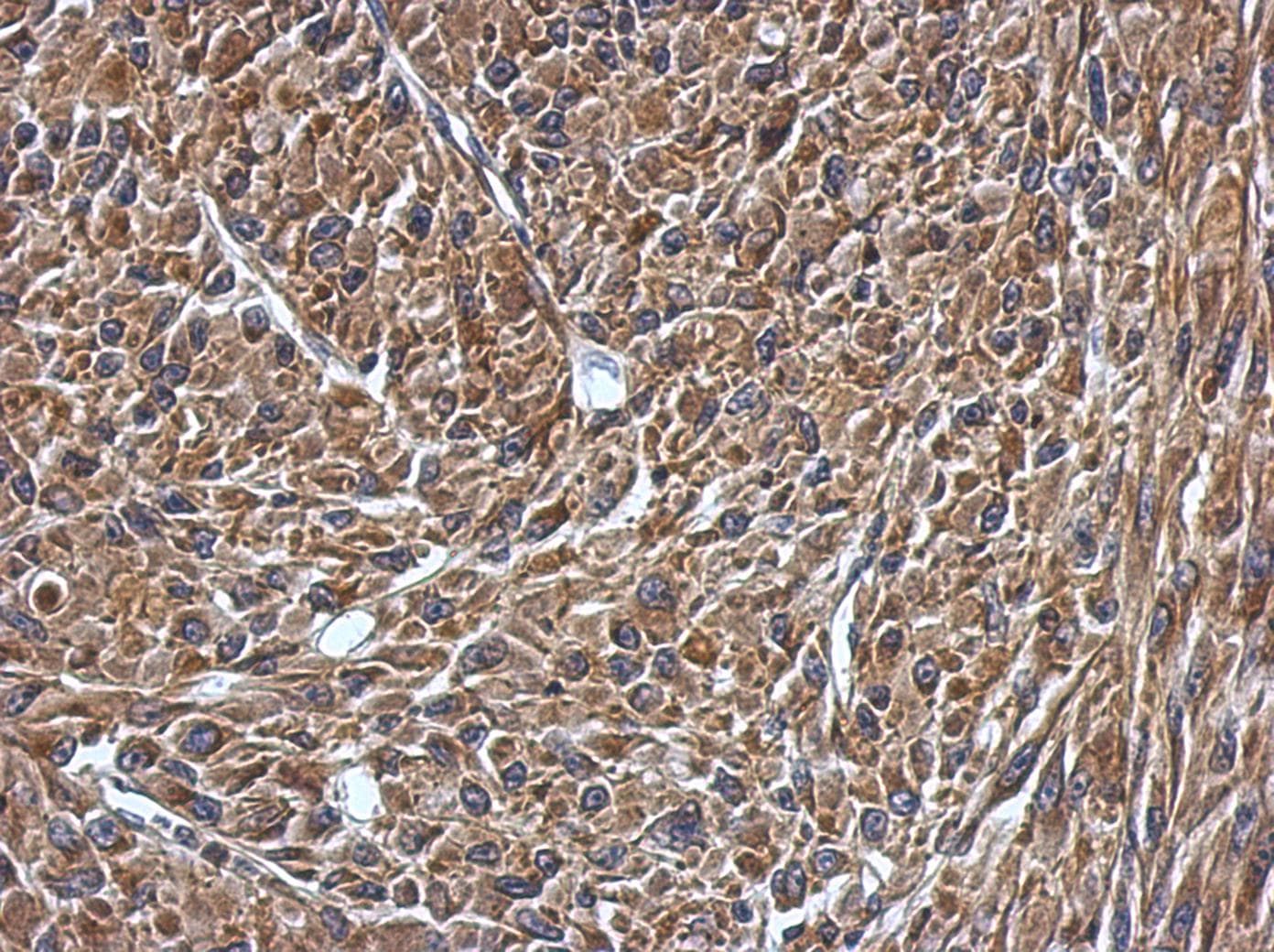 VAMP1 / VAMP-1 Antibody