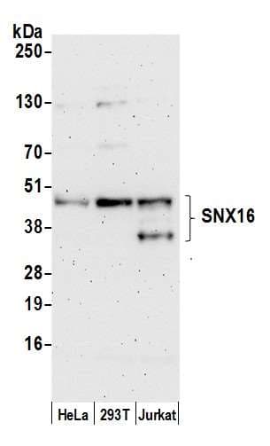 Polyclonal Rabbit anti-Human SNX16 Antibody (aa250-300, WB)