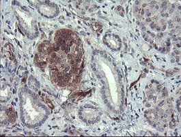TSC22D1 / TSC22 Antibody (clone OTI3B7)