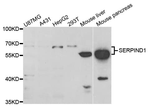 IHC-plus™ SERPIND1 / Heparin Cofactor 2 Antibody
